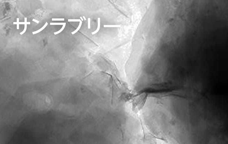 サンラブリー